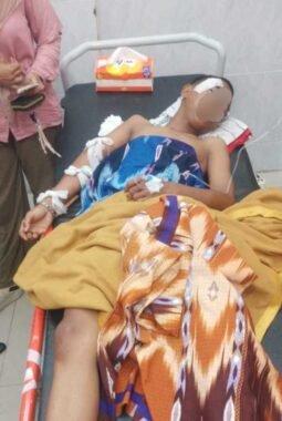 Diduga Jadi Korban Pengeroyokan, Warga Sungai Nibung Alami Luka Bacok dan Dirawat Intensif